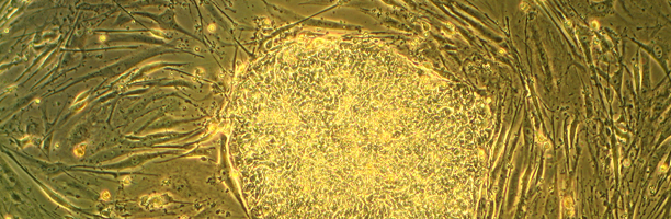 stem cells